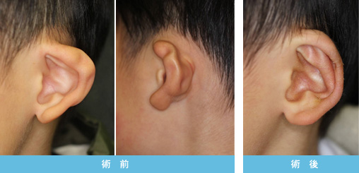 折れ耳 症状2