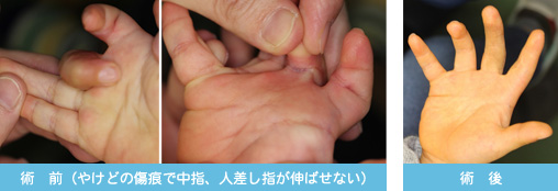 症状