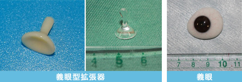 義眼型拡張器