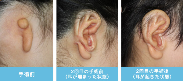 症状2